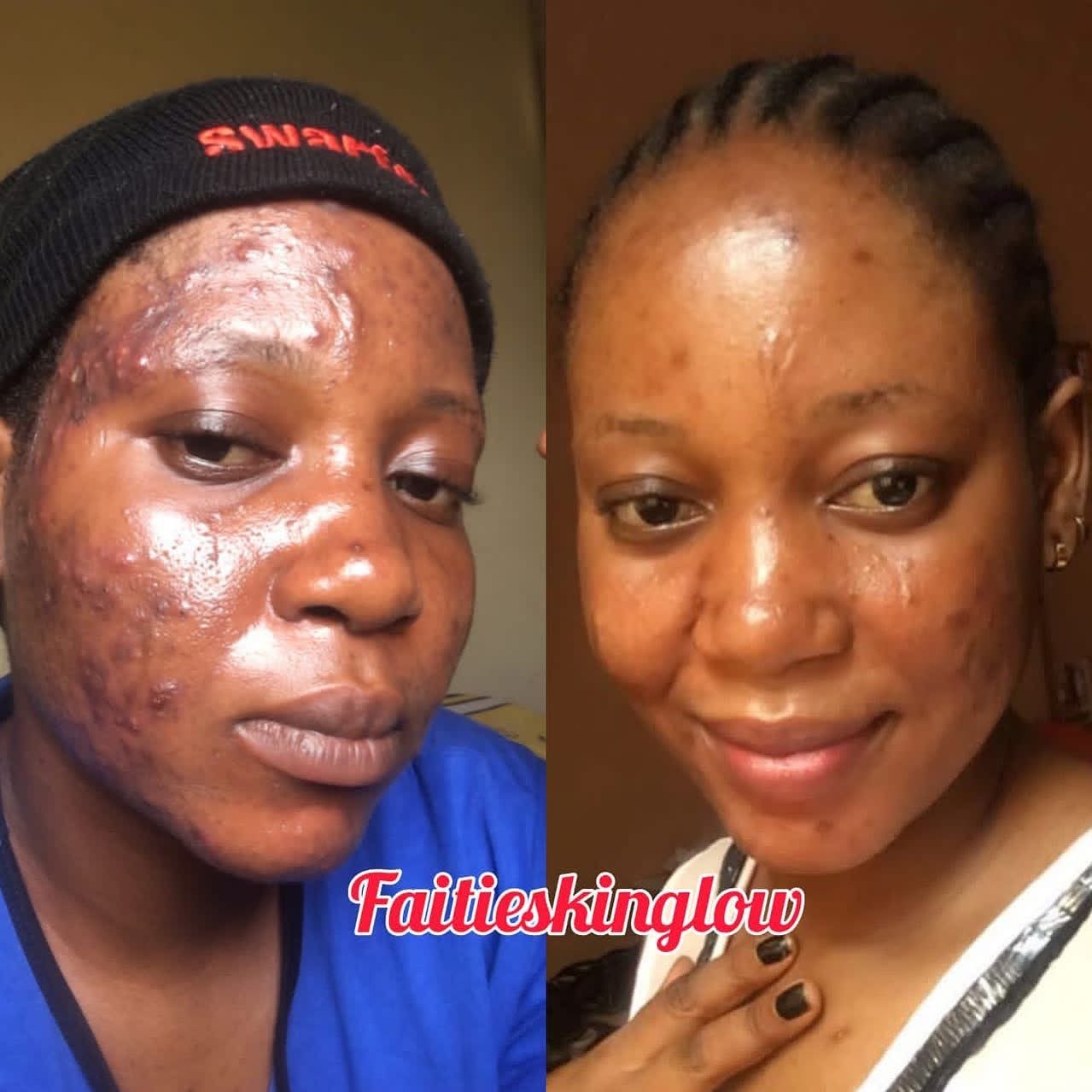 Sensitive skin results